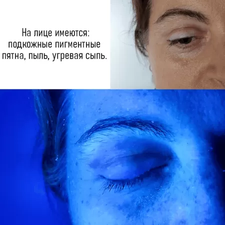 Лампа Вуда B-221 с лупой